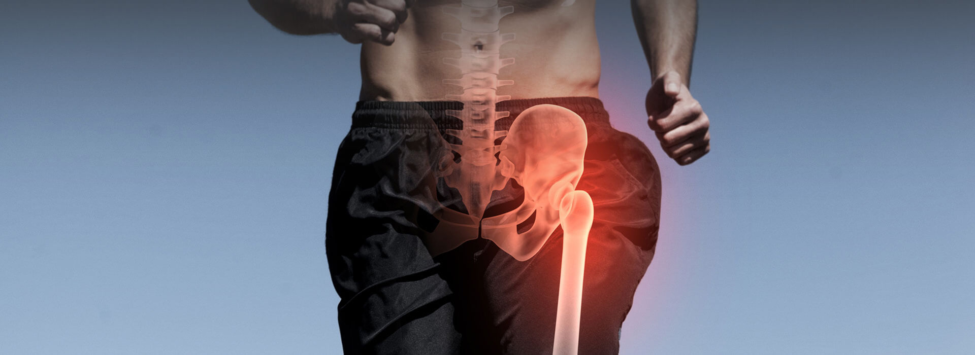 Back Pain Leg Pain with Paresthesia