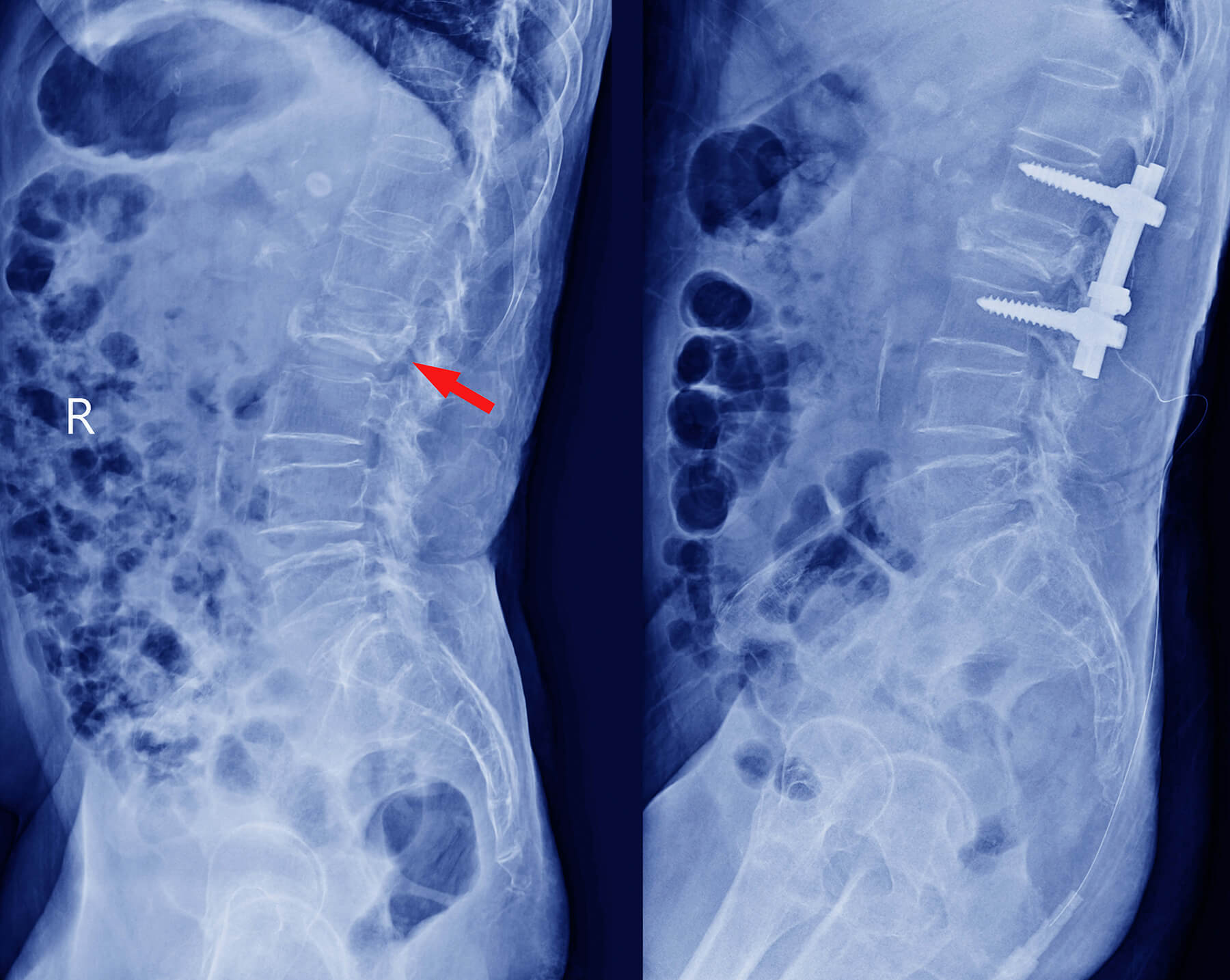 Orthopedic Doctor in Ahmedabad Orthopedic Doctor in Ahmedabad